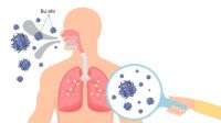 Bệnh bụi phổi Silic nghề nghiệp, nguyên nhân và cách phòng ngừa